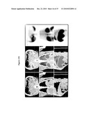 NEW PLASMA MEMBRANE BIOMARKERS PREFERENTIALLY EXPRESSED IN PANCREATIC BETA CELLS USEFUL IN IMAGING OR TARGETING BETA CELLS diagram and image