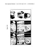 NEW PLASMA MEMBRANE BIOMARKERS PREFERENTIALLY EXPRESSED IN PANCREATIC BETA CELLS USEFUL IN IMAGING OR TARGETING BETA CELLS diagram and image