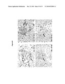 NEW PLASMA MEMBRANE BIOMARKERS PREFERENTIALLY EXPRESSED IN PANCREATIC BETA CELLS USEFUL IN IMAGING OR TARGETING BETA CELLS diagram and image