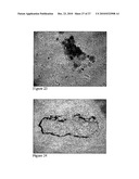 COMPOSITIONS AND METHODS FOR AUGMENTATION AND REGENERATION OF LIVING TISSUE IN A SUBJECT diagram and image