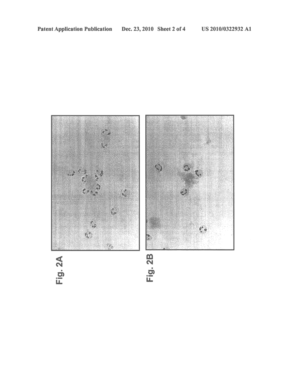 METHODS FOR AMYLOID REMOVAL USING ANTI-AMYLOID ANTIBODIES - diagram, schematic, and image 03