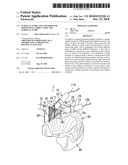 SURGICAL GUIDE AND A METHOD FOR POSITIONING A DRILL USING THE SURGICAL GUIDE diagram and image