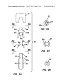 Dental Implant with Interlocking and Centering Threads diagram and image