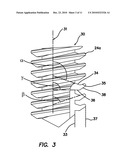 Dental Implant with Interlocking and Centering Threads diagram and image