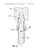 Dental Implant with Interlocking and Centering Threads diagram and image