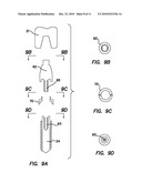 Dental Implant with Interlocking and Centering Threads diagram and image