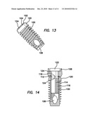 Dental Implant with Interlocking and Centering Threads diagram and image