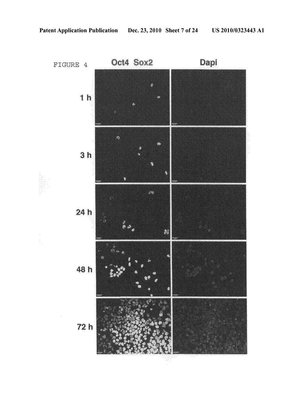 Composition and method for enabling proliferation of pluripotent stem cells - diagram, schematic, and image 08