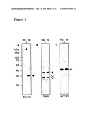 Vhh for the Diagnosis, Prevention and Treatment of Diseases Associated with Protein Aggregates diagram and image