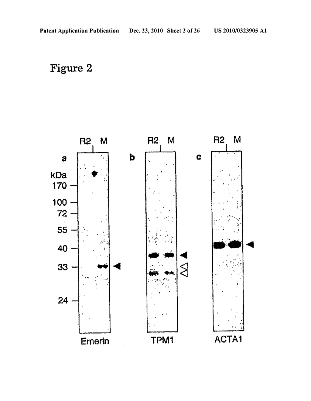 Vhh for the Diagnosis, Prevention and Treatment of Diseases Associated with Protein Aggregates - diagram, schematic, and image 03