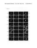 Vhh for the Diagnosis, Prevention and Treatment of Diseases Associated with Protein Aggregates diagram and image