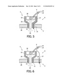 DEVICE AND METHOD FOR IMPROVING HEARING diagram and image