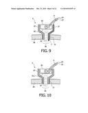 DEVICE AND METHOD FOR IMPROVING HEARING diagram and image