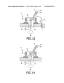 DEVICE AND METHOD FOR IMPROVING HEARING diagram and image