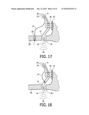 DEVICE AND METHOD FOR IMPROVING HEARING diagram and image