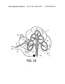 DEVICE AND METHOD FOR IMPROVING HEARING diagram and image