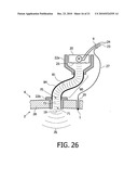 DEVICE AND METHOD FOR IMPROVING HEARING diagram and image