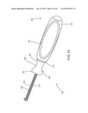 Insertion Device and Method for Delivery of a Mesh Carrier diagram and image