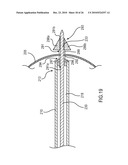 Insertion Device and Method for Delivery of a Mesh Carrier diagram and image