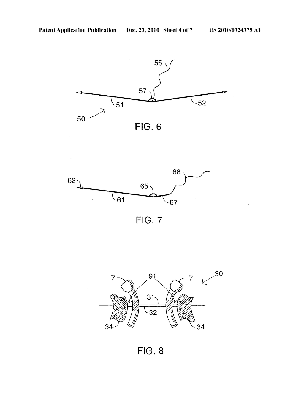 LAPAROSCOPIC INSTRUMENT AND TROCAR SYSTEM AND RELATED SURGICAL METHOD - diagram, schematic, and image 05