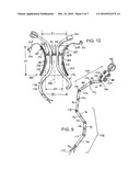 LAPAROSCOPIC INSTRUMENT AND TROCAR SYSTEM AND RELATED SURGICAL METHOD diagram and image