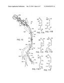 LAPAROSCOPIC INSTRUMENT AND TROCAR SYSTEM AND RELATED SURGICAL METHOD diagram and image