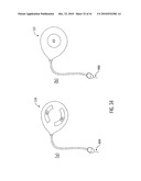 CLOSED-LOOP GLUCOSE AND/OR INSULIN CONTROL SYSTEM diagram and image