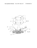 METHOD AND DEVICE TO DETECT EATING, TO CONTROL ARTIFICIAL GASTRIC STIMULATION diagram and image