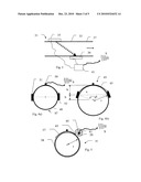 METHOD AND DEVICE TO DETECT EATING, TO CONTROL ARTIFICIAL GASTRIC STIMULATION diagram and image