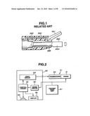 Ultrasound treatment system diagram and image