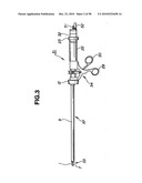 Ultrasound treatment system diagram and image