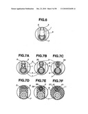 Ultrasound treatment system diagram and image