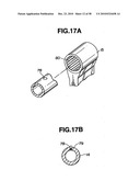 Ultrasound treatment system diagram and image