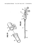 Ultrasound treatment system diagram and image