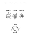 Ultrasound treatment system diagram and image