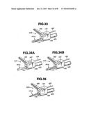 Ultrasound treatment system diagram and image