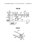 Ultrasound treatment system diagram and image