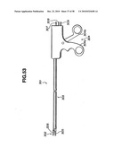 Ultrasound treatment system diagram and image