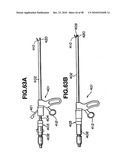 Ultrasound treatment system diagram and image