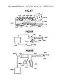 Ultrasound treatment system diagram and image