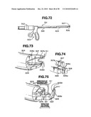 Ultrasound treatment system diagram and image