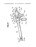 Ultrasound treatment system diagram and image