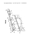 Ultrasound treatment system diagram and image