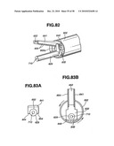 Ultrasound treatment system diagram and image