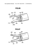 Ultrasound treatment system diagram and image