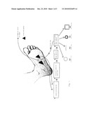  CARDIAC SHOCK WAVE MEDICAL INSTRUMENT diagram and image