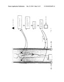  CARDIAC SHOCK WAVE MEDICAL INSTRUMENT diagram and image