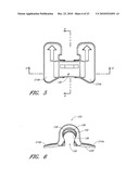 SECUREMENT DEVICE diagram and image