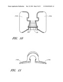 SECUREMENT DEVICE diagram and image