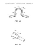 SECUREMENT DEVICE diagram and image